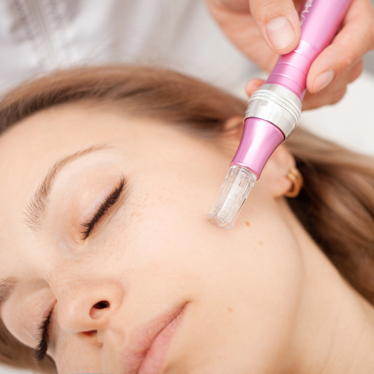 Collagen Induction Microneedling Facial